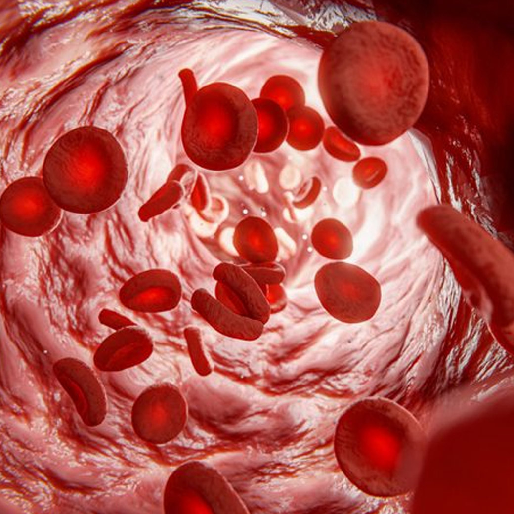 DFPP血液淨化療程