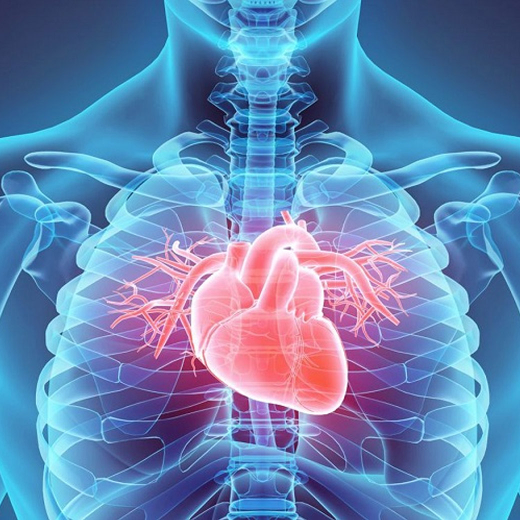 EECP體外反搏治療